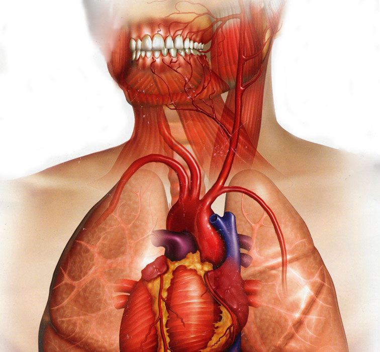 Endocardite Bacteriana